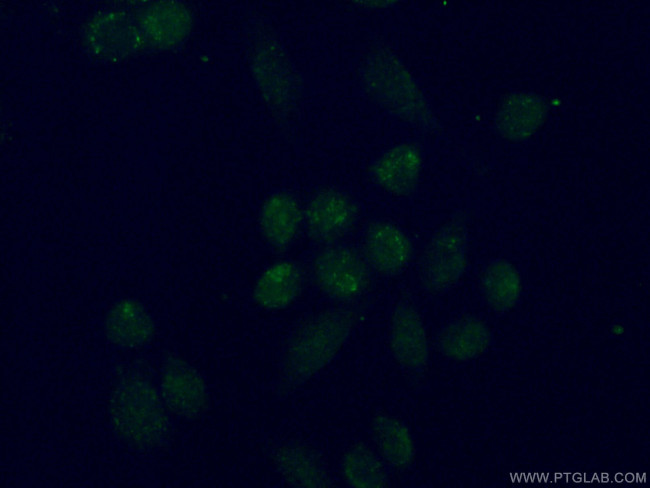 TBX2 Antibody in Immunocytochemistry (ICC/IF)