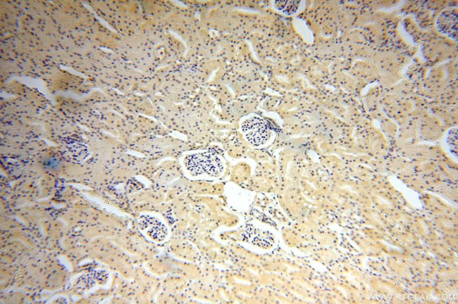 TBX2 Antibody in Immunohistochemistry (Paraffin) (IHC (P))