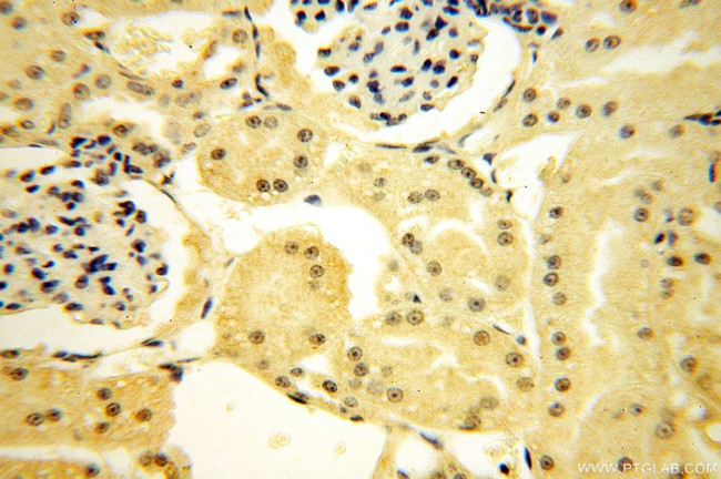 TBX2 Antibody in Immunohistochemistry (Paraffin) (IHC (P))