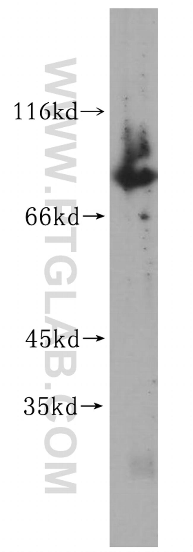 TBX2 Antibody in Western Blot (WB)