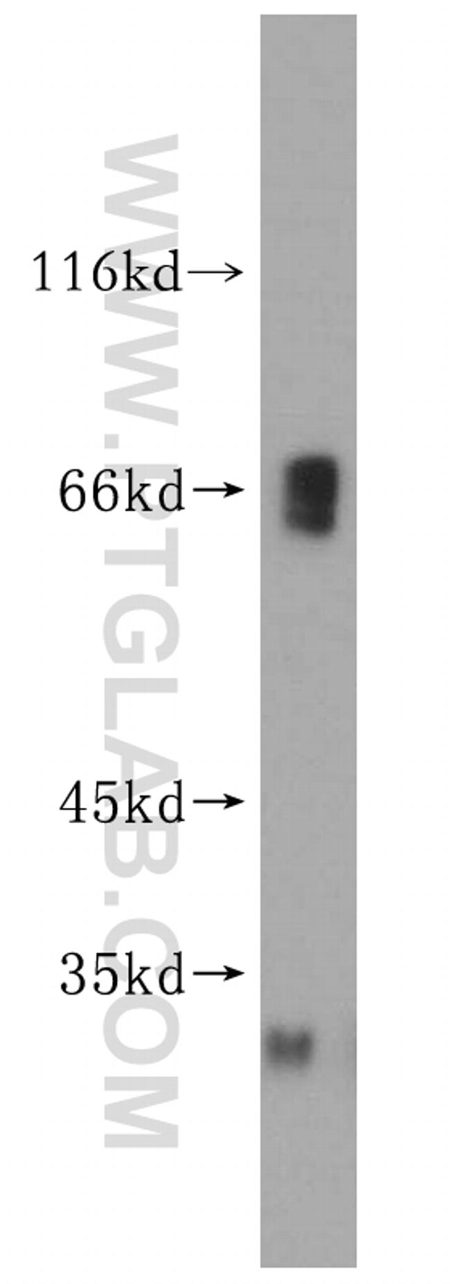 KLHL3 Antibody in Western Blot (WB)