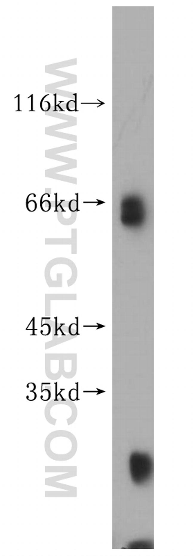 KLHL3 Antibody in Western Blot (WB)