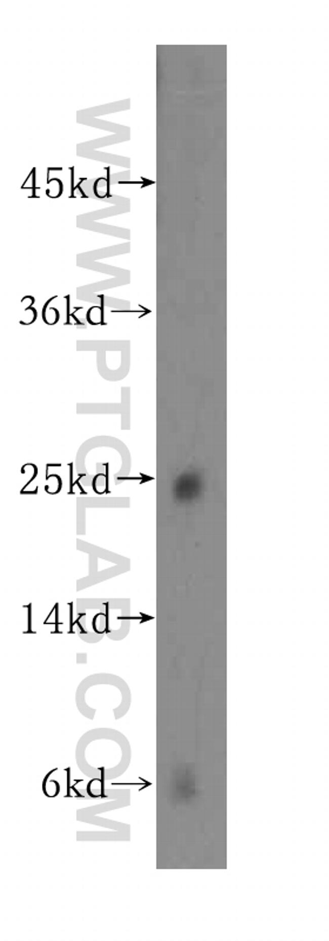 N6AMT2 Antibody in Western Blot (WB)