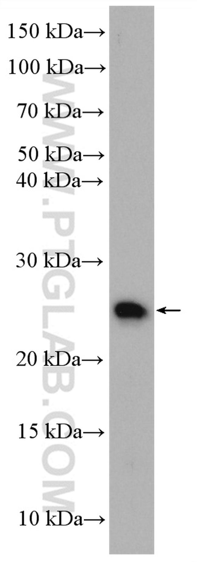 N6AMT2 Antibody in Western Blot (WB)