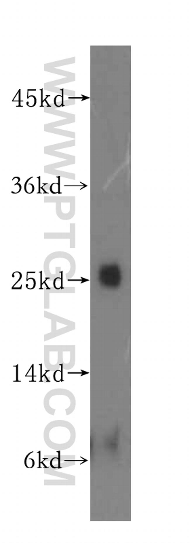 N6AMT2 Antibody in Western Blot (WB)