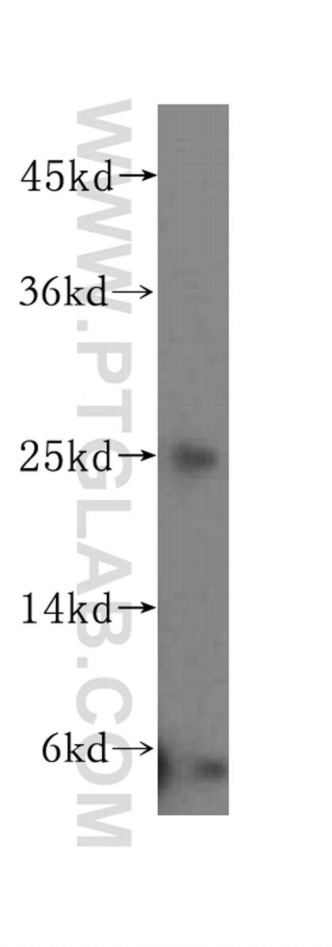 N6AMT2 Antibody in Western Blot (WB)