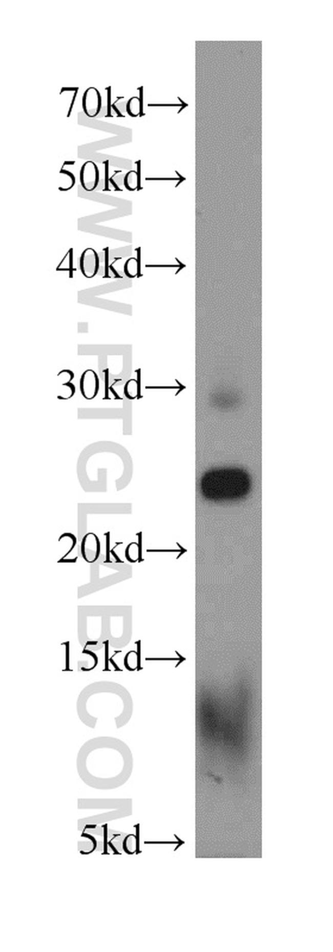 RPS5 Antibody in Western Blot (WB)