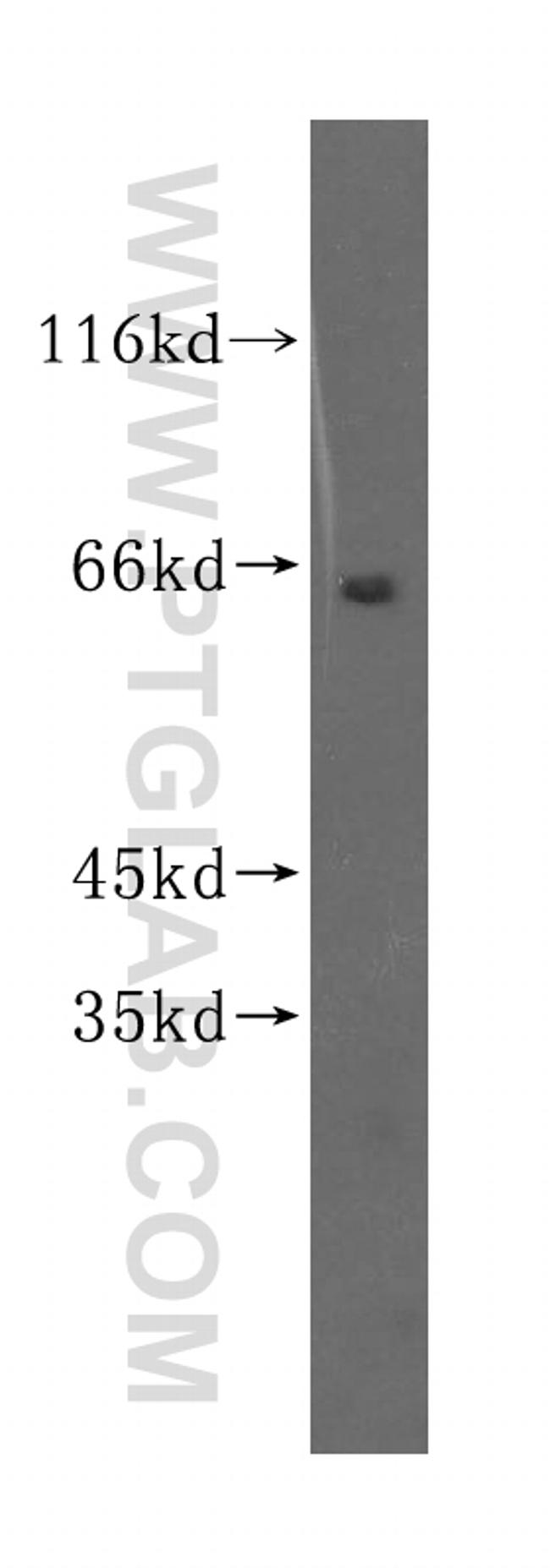 SGOL1 Antibody in Western Blot (WB)