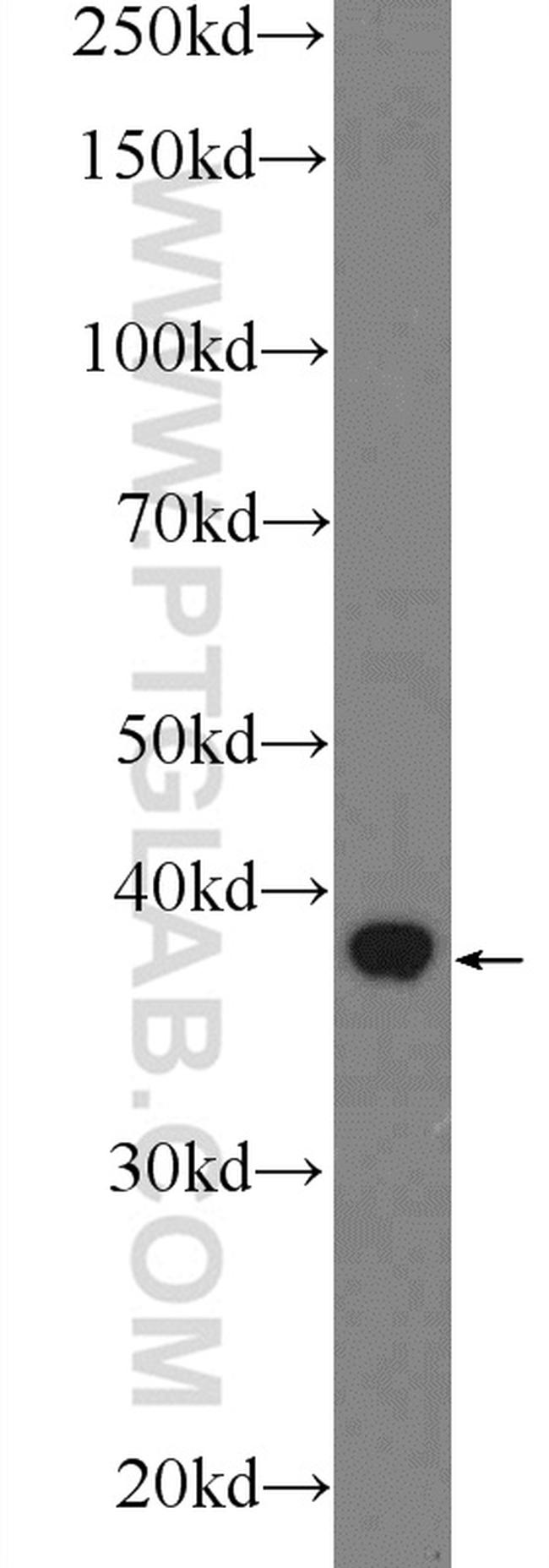 SPATA22 Antibody in Western Blot (WB)