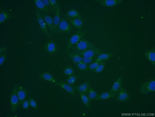 MGAT5B Antibody in Immunocytochemistry (ICC/IF)