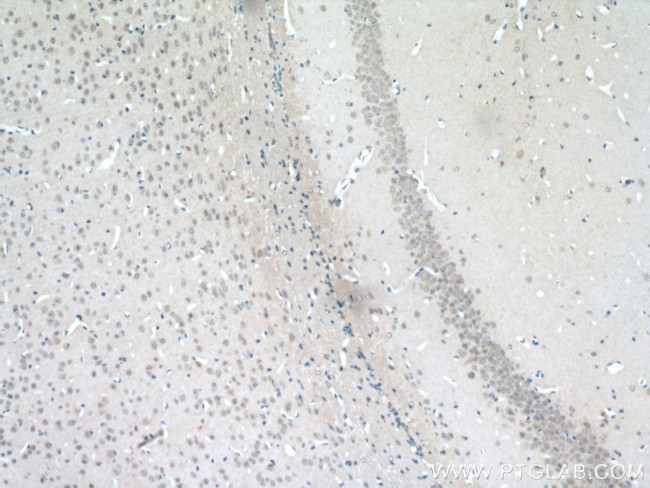 MGAT5B Antibody in Immunohistochemistry (Paraffin) (IHC (P))