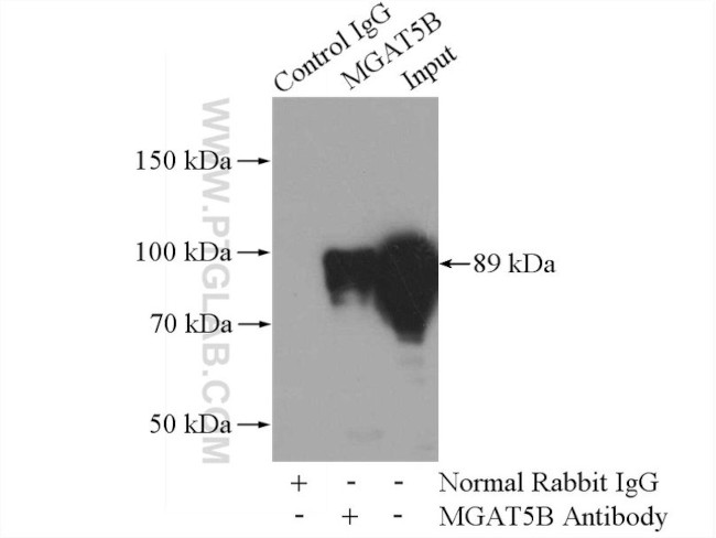 MGAT5B Antibody in Immunoprecipitation (IP)