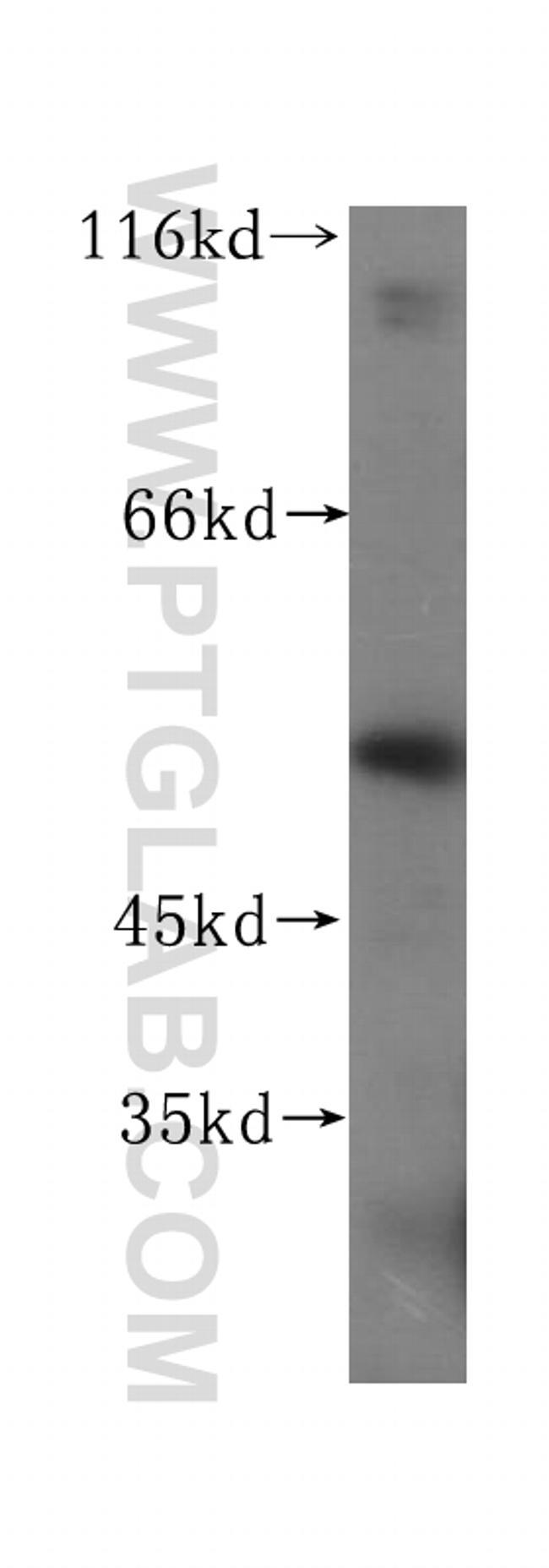 UFSP2 Antibody in Western Blot (WB)