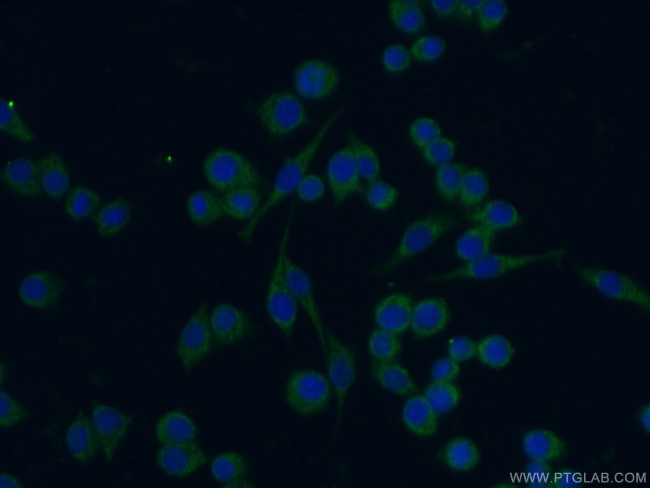 CD14 Antibody in Immunocytochemistry (ICC/IF)