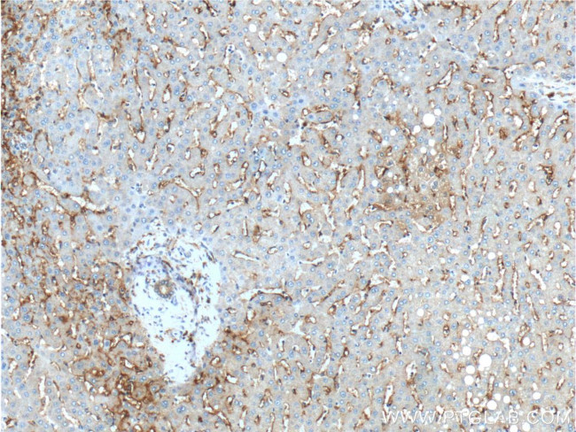 CD14 Antibody in Immunohistochemistry (Paraffin) (IHC (P))