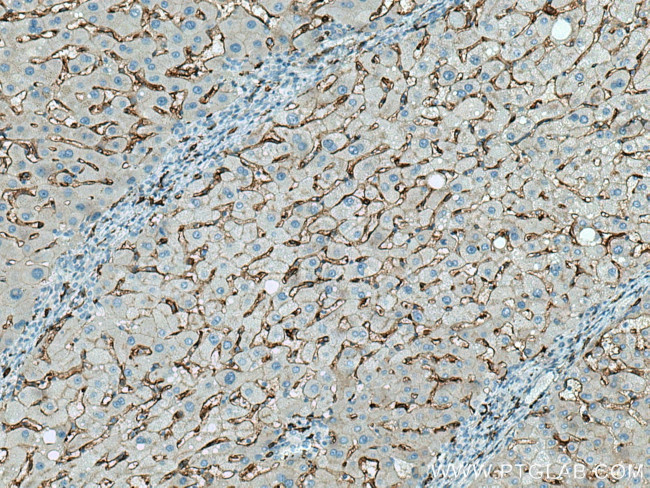 CD14 Antibody in Immunohistochemistry (Paraffin) (IHC (P))