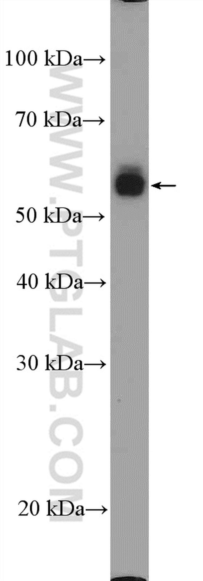 CD14 Antibody in Western Blot (WB)