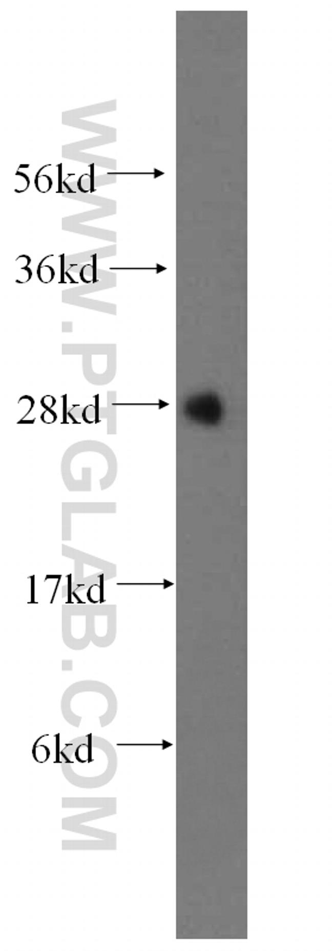 METTL7B Antibody in Western Blot (WB)