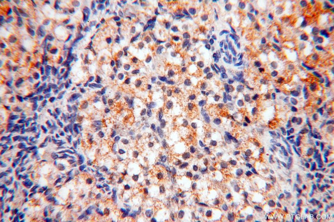 MRPS15 Antibody in Immunohistochemistry (Paraffin) (IHC (P))