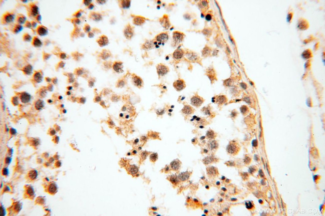 MRPS15 Antibody in Immunohistochemistry (Paraffin) (IHC (P))