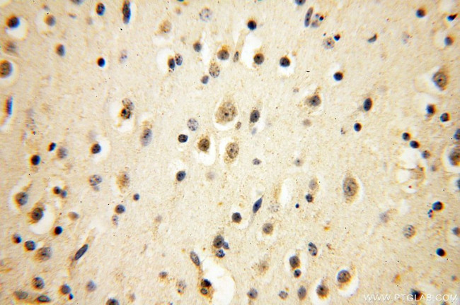 MRPS15 Antibody in Immunohistochemistry (Paraffin) (IHC (P))