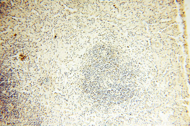 MRPS15 Antibody in Immunohistochemistry (Paraffin) (IHC (P))