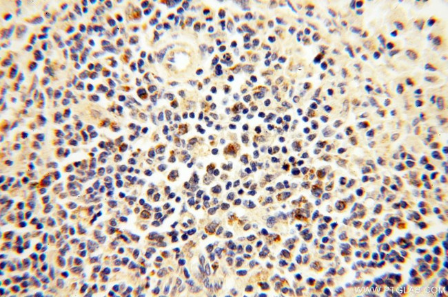 MRPS15 Antibody in Immunohistochemistry (Paraffin) (IHC (P))