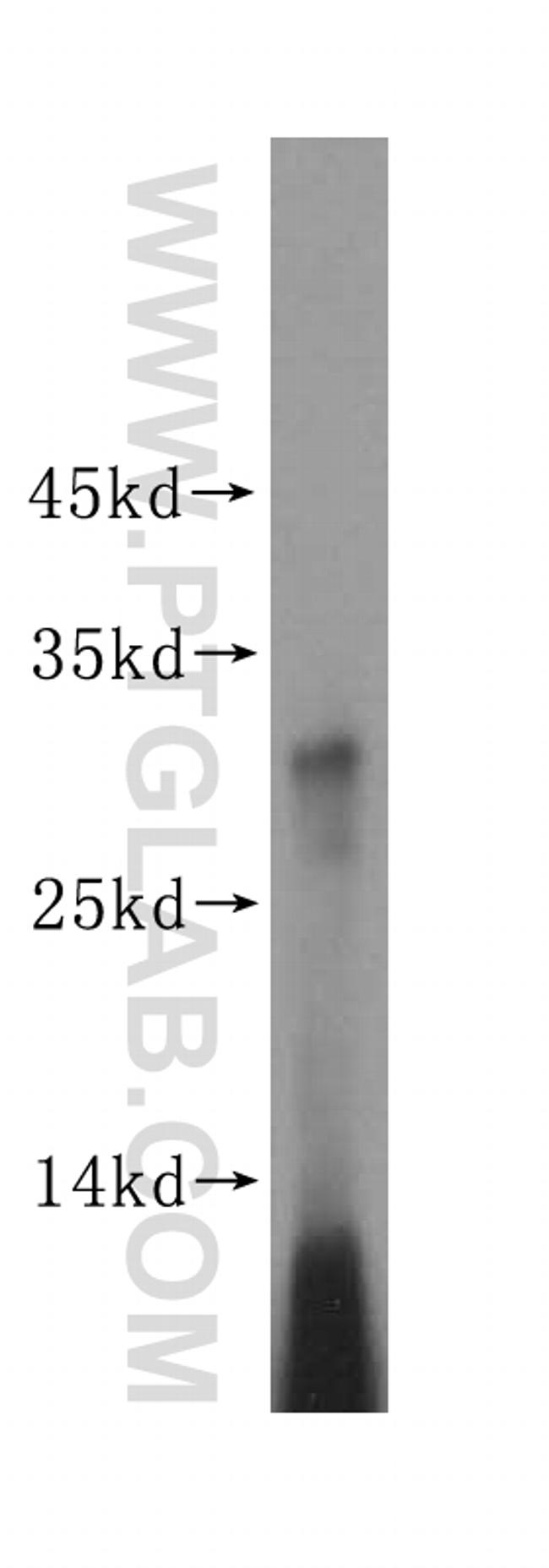 MRPS15 Antibody in Western Blot (WB)