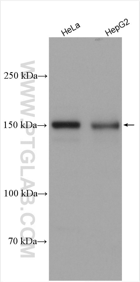 RECQL4 Antibody in Western Blot (WB)