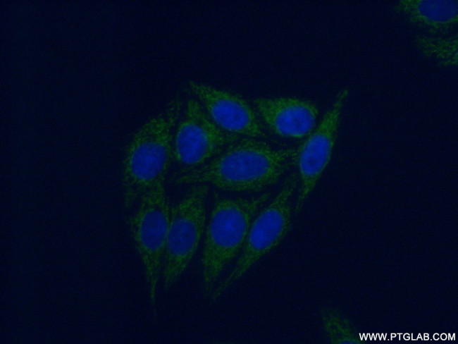 PPM1F Antibody in Immunocytochemistry (ICC/IF)