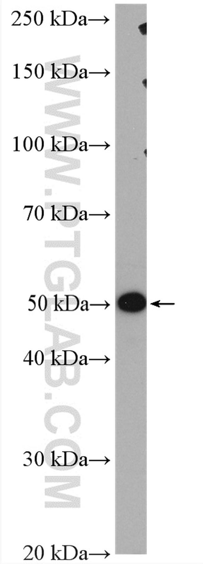 PPM1F Antibody in Western Blot (WB)