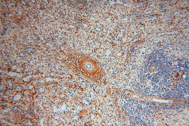 Collagen Type VI Antibody in Immunohistochemistry (Paraffin) (IHC (P))