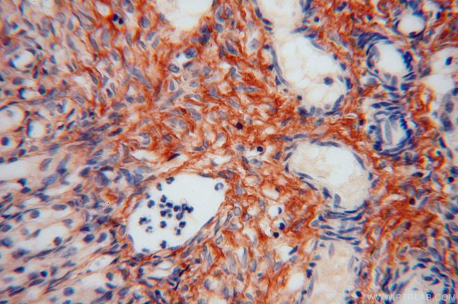 Collagen Type VI Antibody in Immunohistochemistry (Paraffin) (IHC (P))