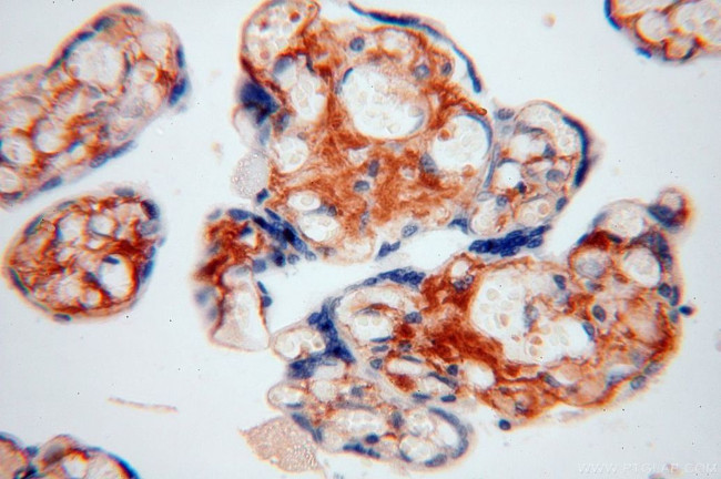 Collagen Type VI Antibody in Immunohistochemistry (Paraffin) (IHC (P))