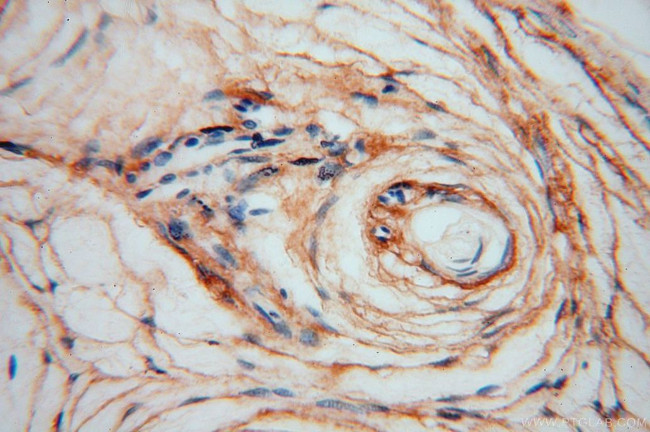 Collagen Type VI Antibody in Immunohistochemistry (Paraffin) (IHC (P))