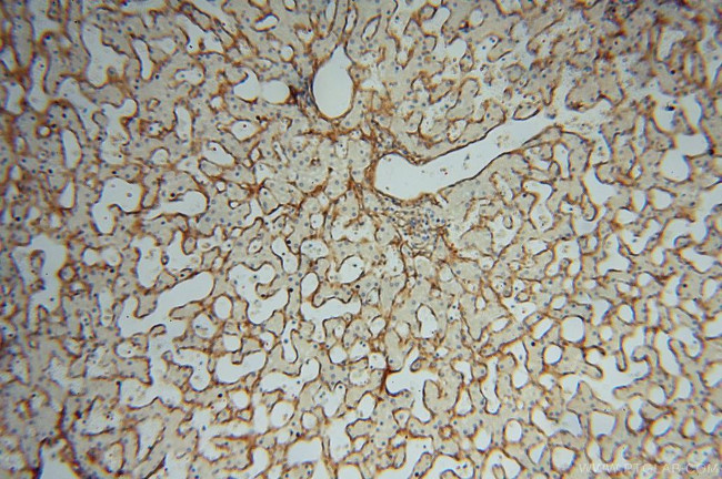 Collagen Type VI Antibody in Immunohistochemistry (Paraffin) (IHC (P))