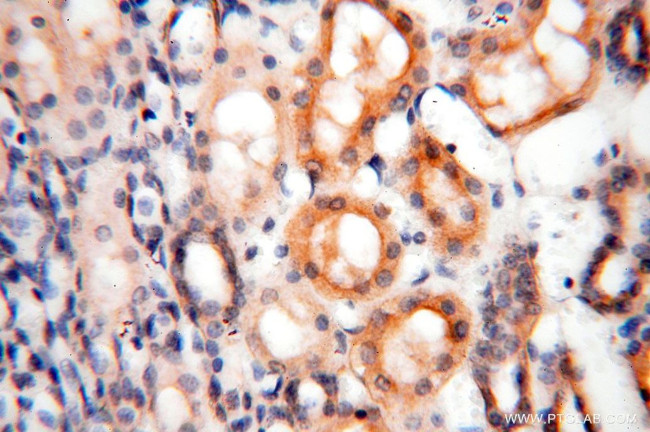 ROGDI Antibody in Immunohistochemistry (Paraffin) (IHC (P))