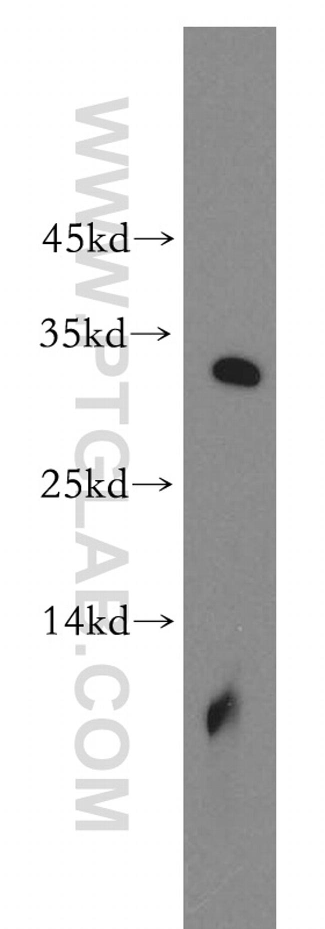 ROGDI Antibody in Western Blot (WB)