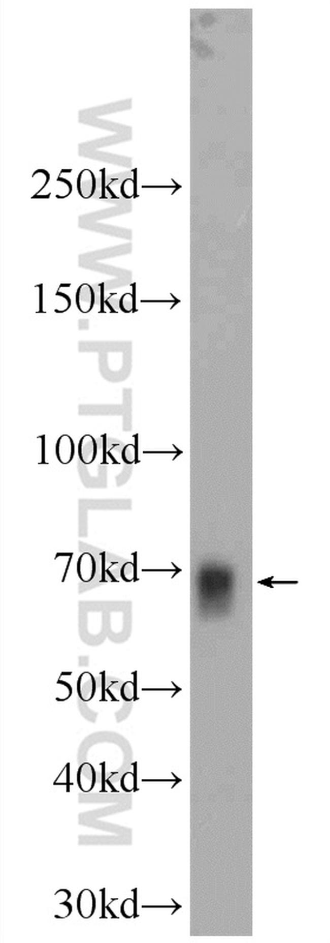 NFE2L1 Antibody in Western Blot (WB)