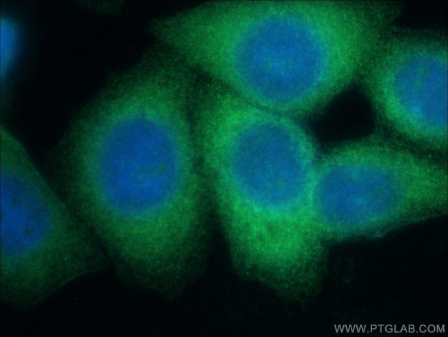 LZTFL1 Antibody in Immunocytochemistry (ICC/IF)