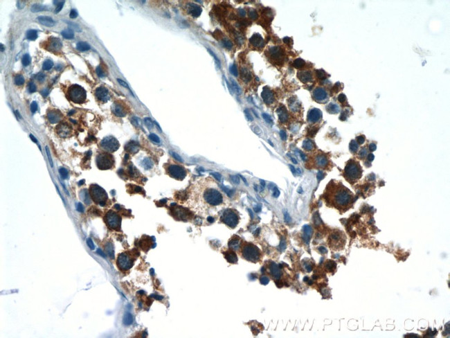 LZTFL1 Antibody in Immunohistochemistry (Paraffin) (IHC (P))