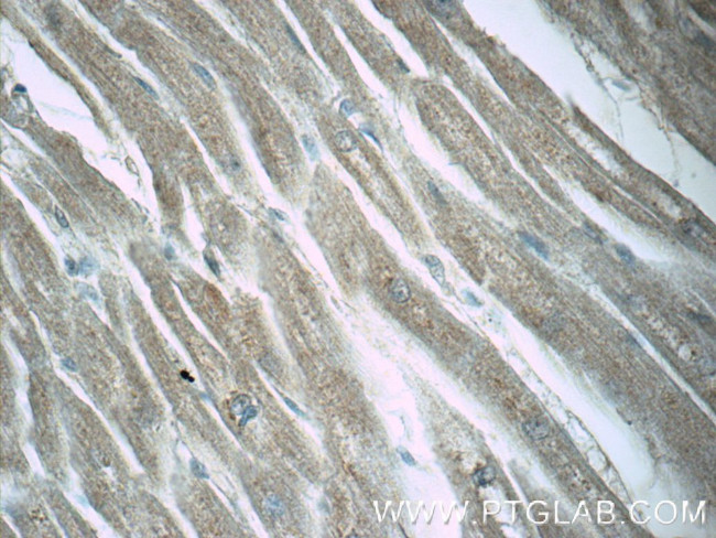 LZTFL1 Antibody in Immunohistochemistry (Paraffin) (IHC (P))