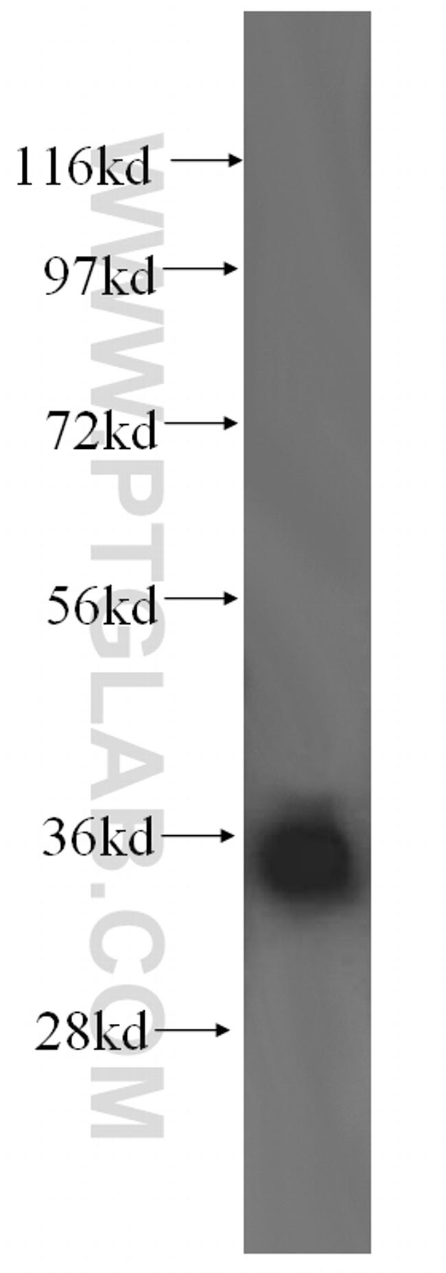 LZTFL1 Antibody in Western Blot (WB)