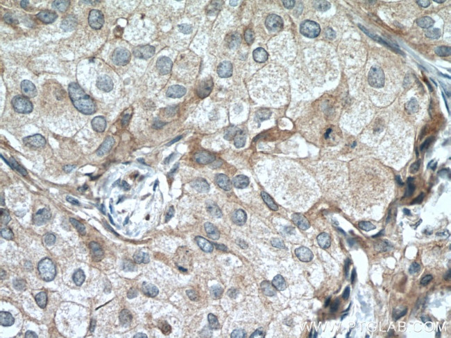 CST6 Antibody in Immunohistochemistry (Paraffin) (IHC (P))