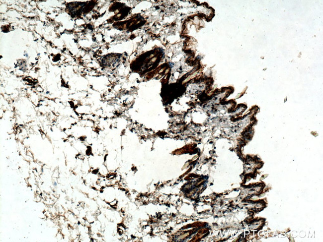 CST6 Antibody in Immunohistochemistry (Paraffin) (IHC (P))