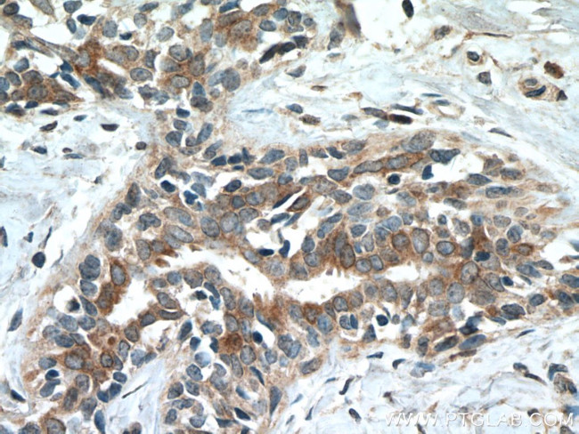 CST6 Antibody in Immunohistochemistry (Paraffin) (IHC (P))