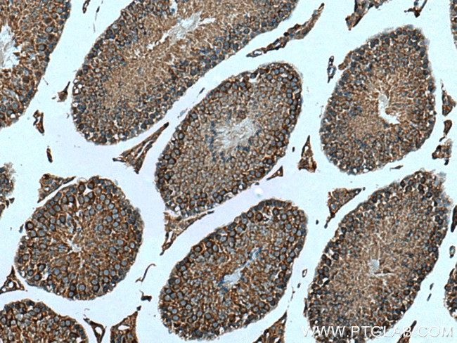 TBC1D5 Antibody in Immunohistochemistry (Paraffin) (IHC (P))