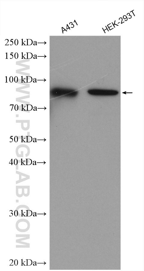 TBC1D5 Antibody in Western Blot (WB)