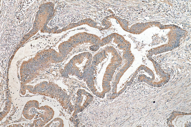 LARS2 Antibody in Immunohistochemistry (Paraffin) (IHC (P))