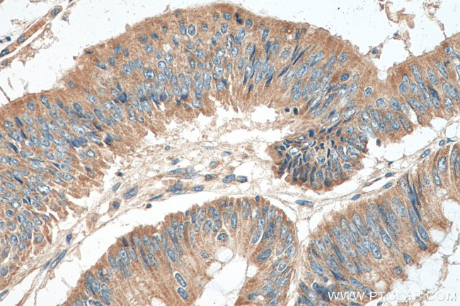 LARS2 Antibody in Immunohistochemistry (Paraffin) (IHC (P))